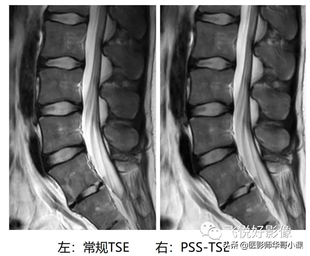 飞利浦磁共振波谱扫描方案,飞利浦1.5t磁共振mri操作使用手册