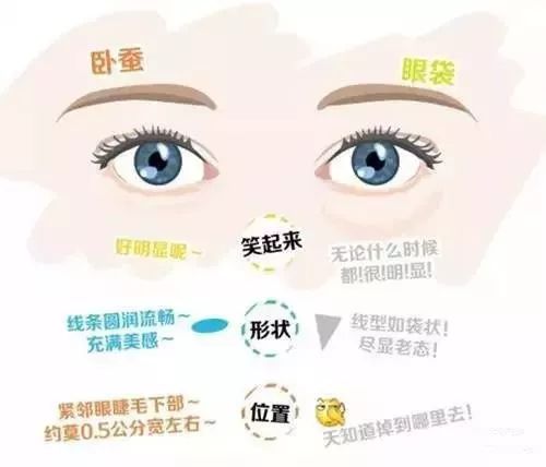 不手术也能去眼袋吗,不开刀去眼袋手术的原理是什么