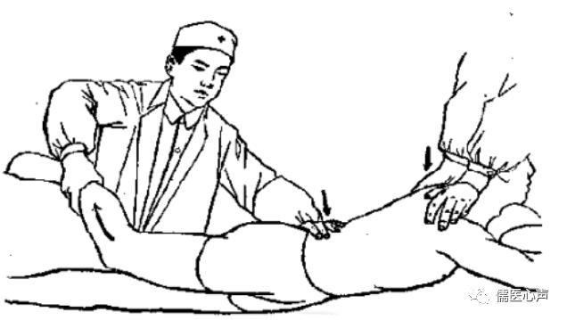 腰痛之捉妖记（十四）------能动还是能冻，神秘的骶髂（上）