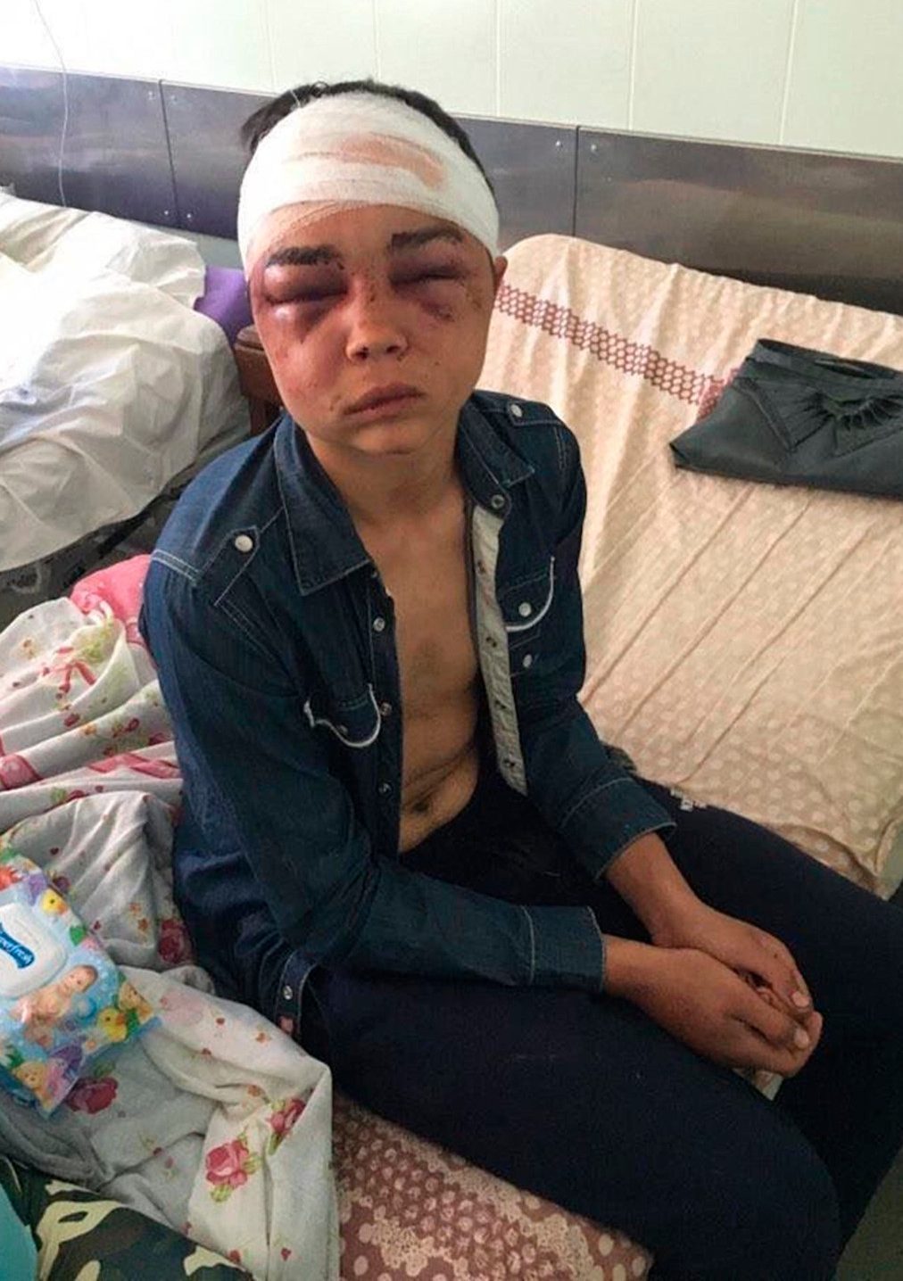 俄17岁男孩与前女友约会，被她男友发现用铲柄奸虐，致严重内出血