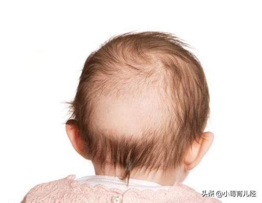 婴儿缺钙的症状和治疗方法,缺钙的宝宝有哪些症状与表现