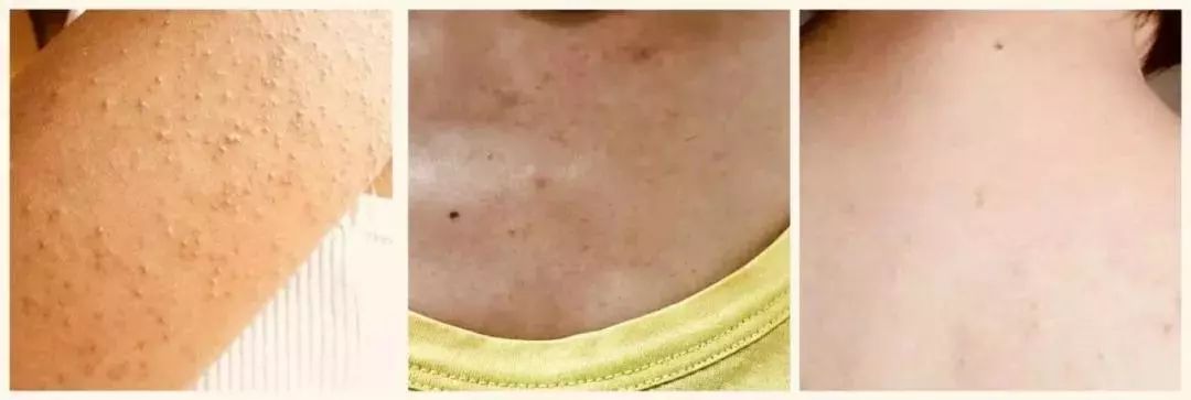 王鸥露背装,王鸥复古露背