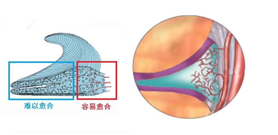 哪些明星半月板撕裂过,膝关节损伤的明星