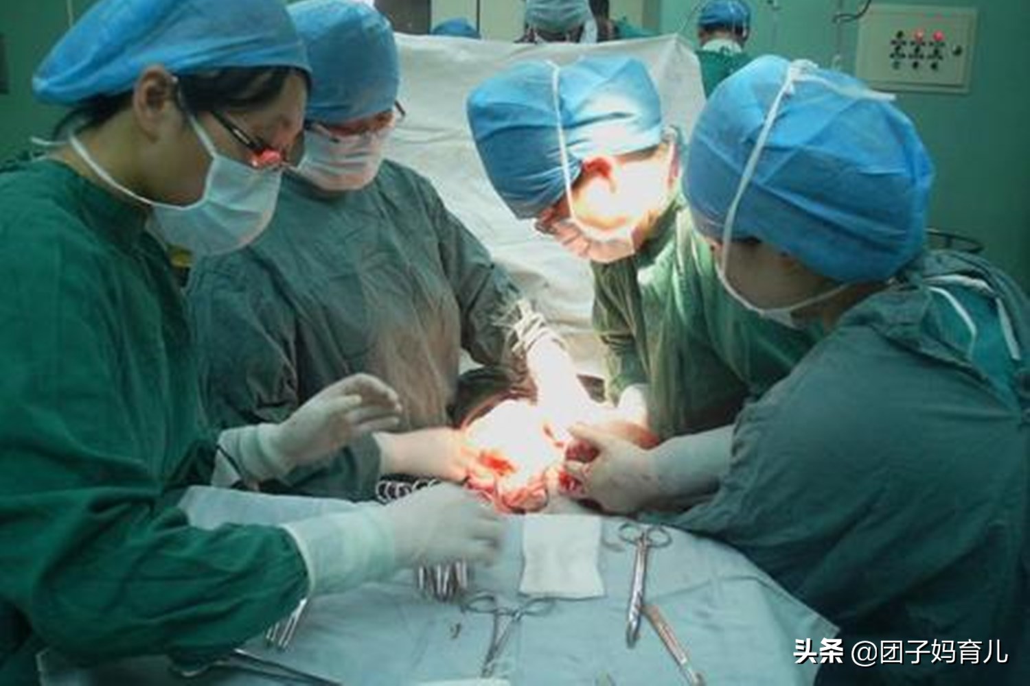 剖腹产生娃也能改善体质吗,剖腹产半麻醉生孩子的真实流程