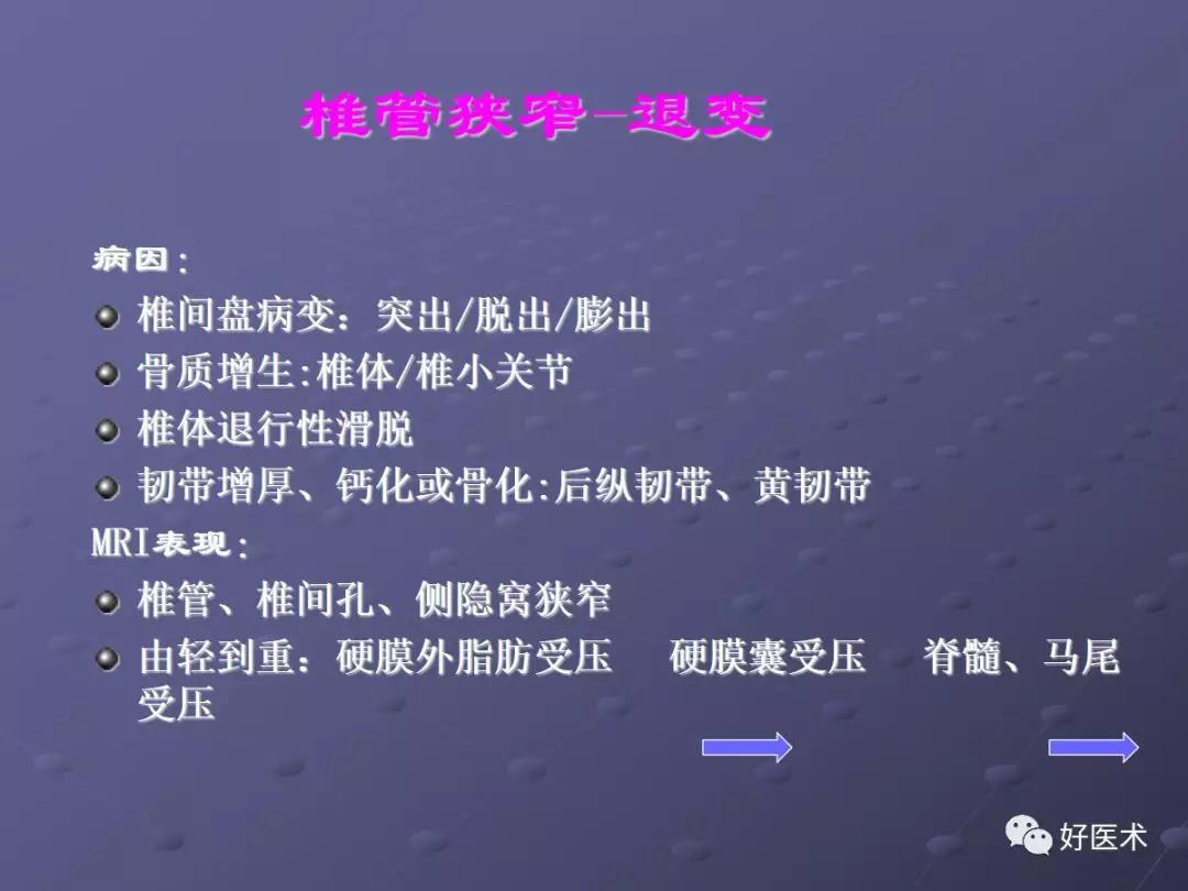 脊柱mri有哪些特点,乳腺疾病的mri诊断及鉴别