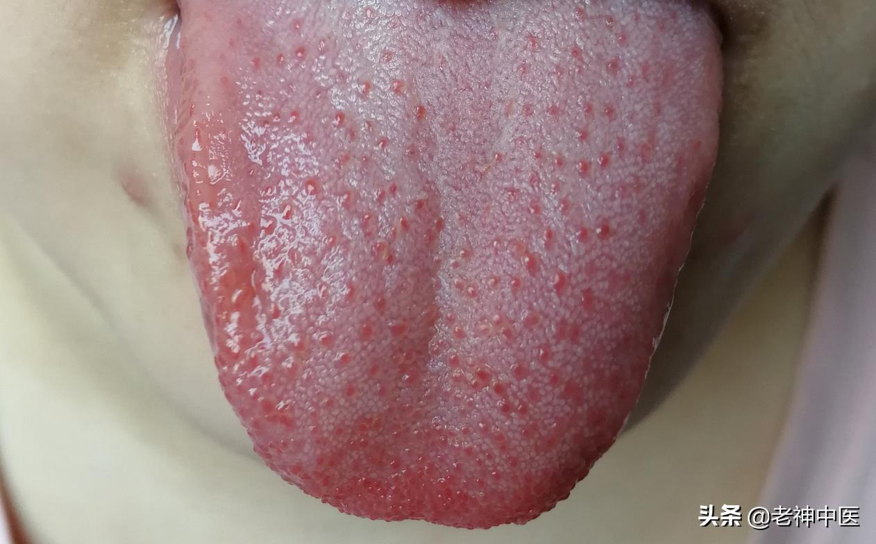 孩子口舌生疮，疼痛太难当；引热从小便解，用宋时古方