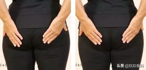 臀中肌无力会引起腰痛吗,腰背力量太弱的表现
