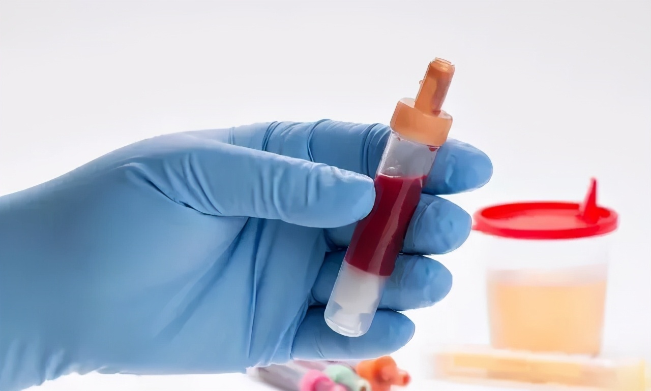 紫癜性肾炎一般要多久康复,紫癜性肾炎治疗多久能得到缓解