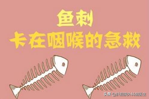 有鱼刺在喉咙里怎么办,有鱼刺扎到手怎么办