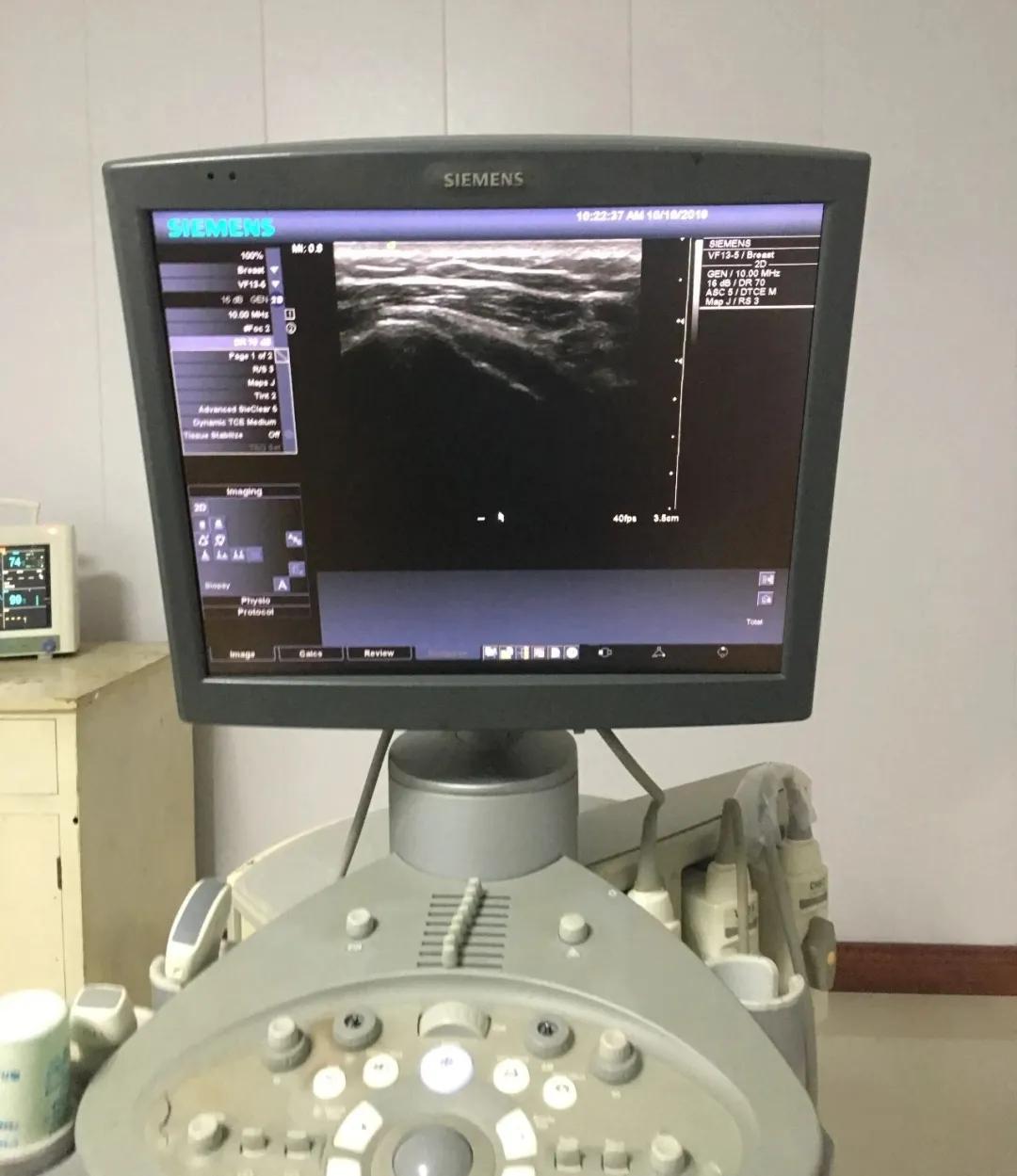 漳浦县医院疼痛科,超声引导下疼痛微创治疗