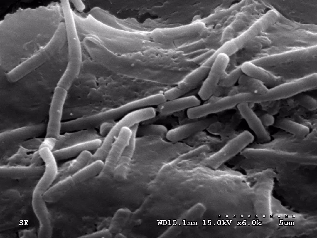 瑞士乳双歧杆菌的作用,罗伊氏乳杆菌和瑞士乳杆菌