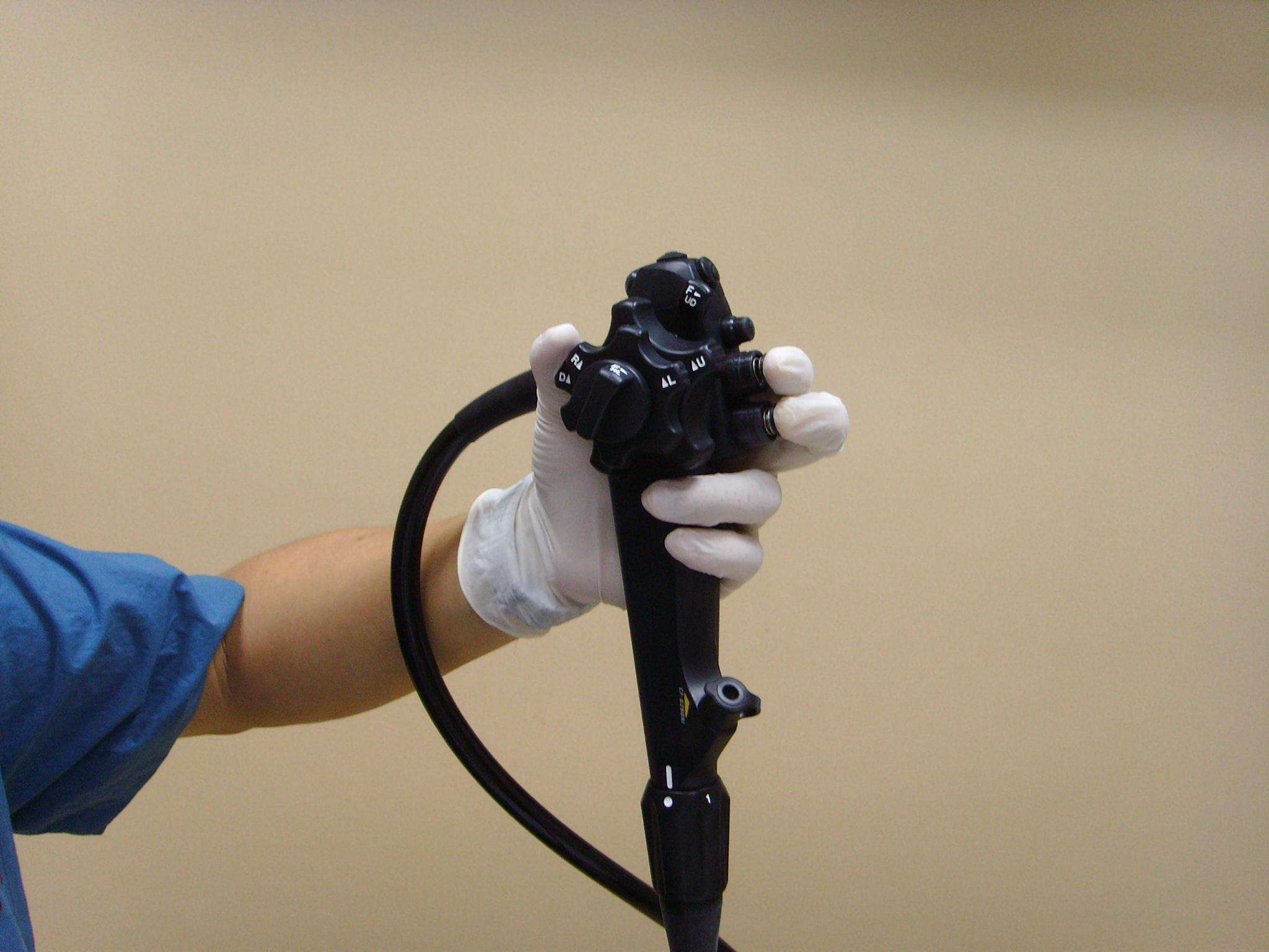 胃镜取出钛夹会伤胃吗,胃镜检查到底伤不伤胃