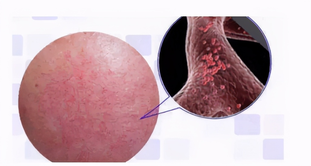 肌肤敏感泛红用什么水乳,肌肤敏感泛红用什么护肤品