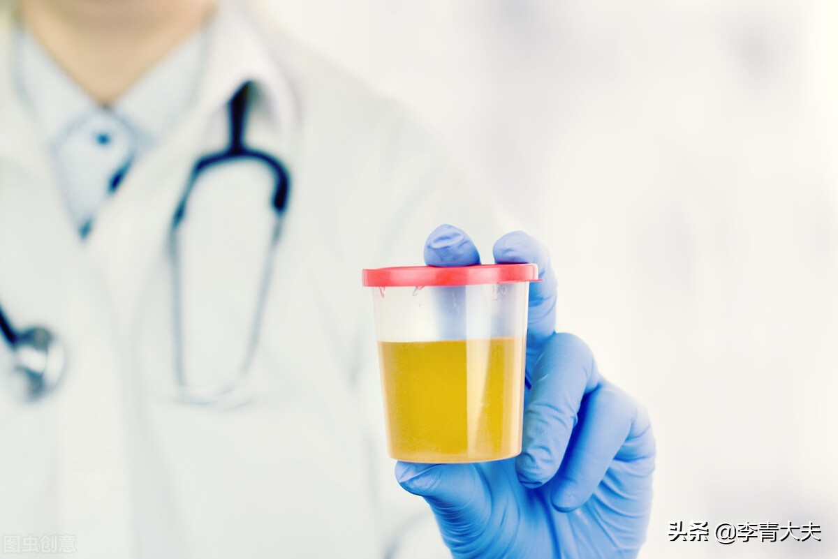 世界肾脏日:尿蛋白的检测方法有哪些?