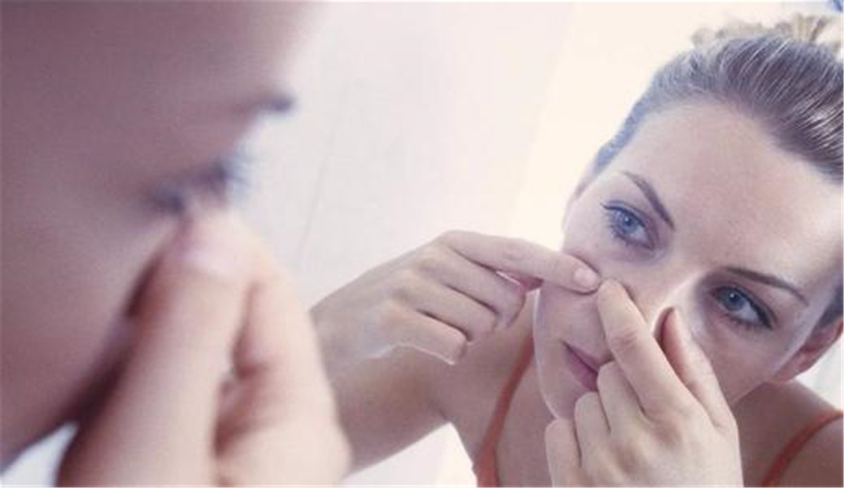 “危险三角区”的痘痘千万不能挤！有人挤了一下，结果留下后遗症