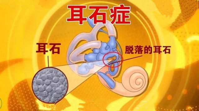 你知道什么叫头晕吗,你知道什么原因引起的头晕吗