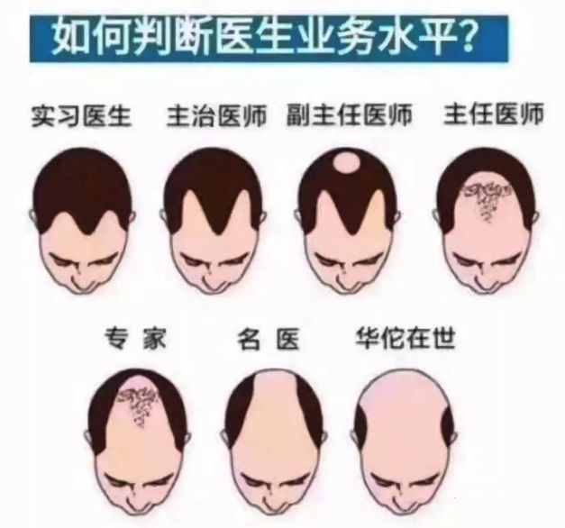 脱发秃顶严重怎么调理男,男士怎么防脱发秃顶