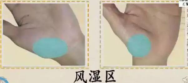 手诊10种常见病从手上就能看出来,手上健康的秘密