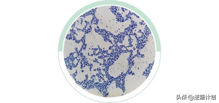 头皮发痒头皮屑多有小疙瘩怎么办,头皮严重发痒头皮屑多小妙招