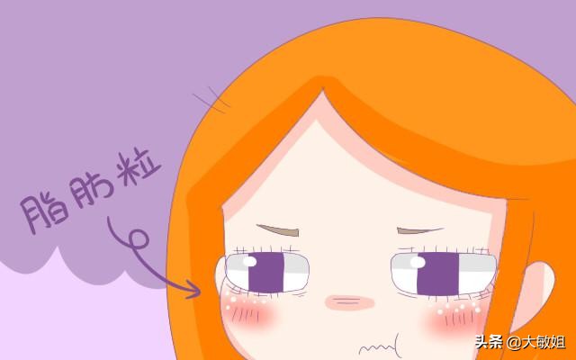 脸上有好多脂肪颗粒怎么办,脸上长脂肪粒的原因和解决方法