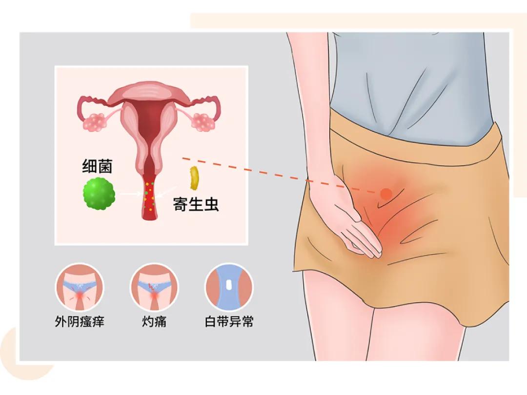 处女不会得妇科病？“啪啪”多了会变松？去你的吧