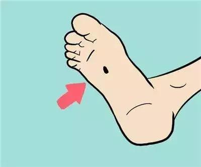 黑痣去除的正确方法是什么,黑痣去除细节注意事项