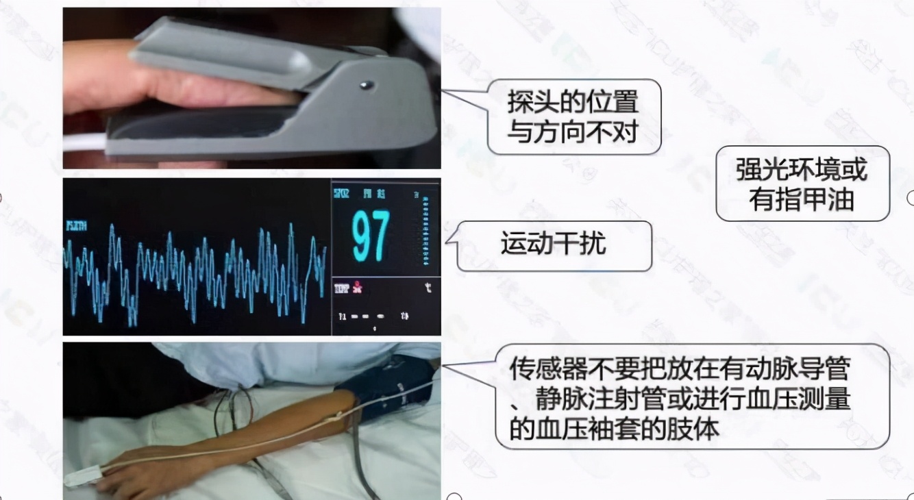 心电监护使用ppt,心电监护使用时间计算