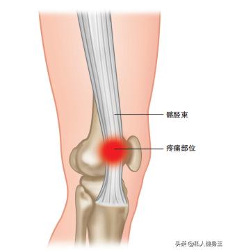膝盖疼痛是不是内脏出问题了,膝盖疼痛的原因和治疗方法