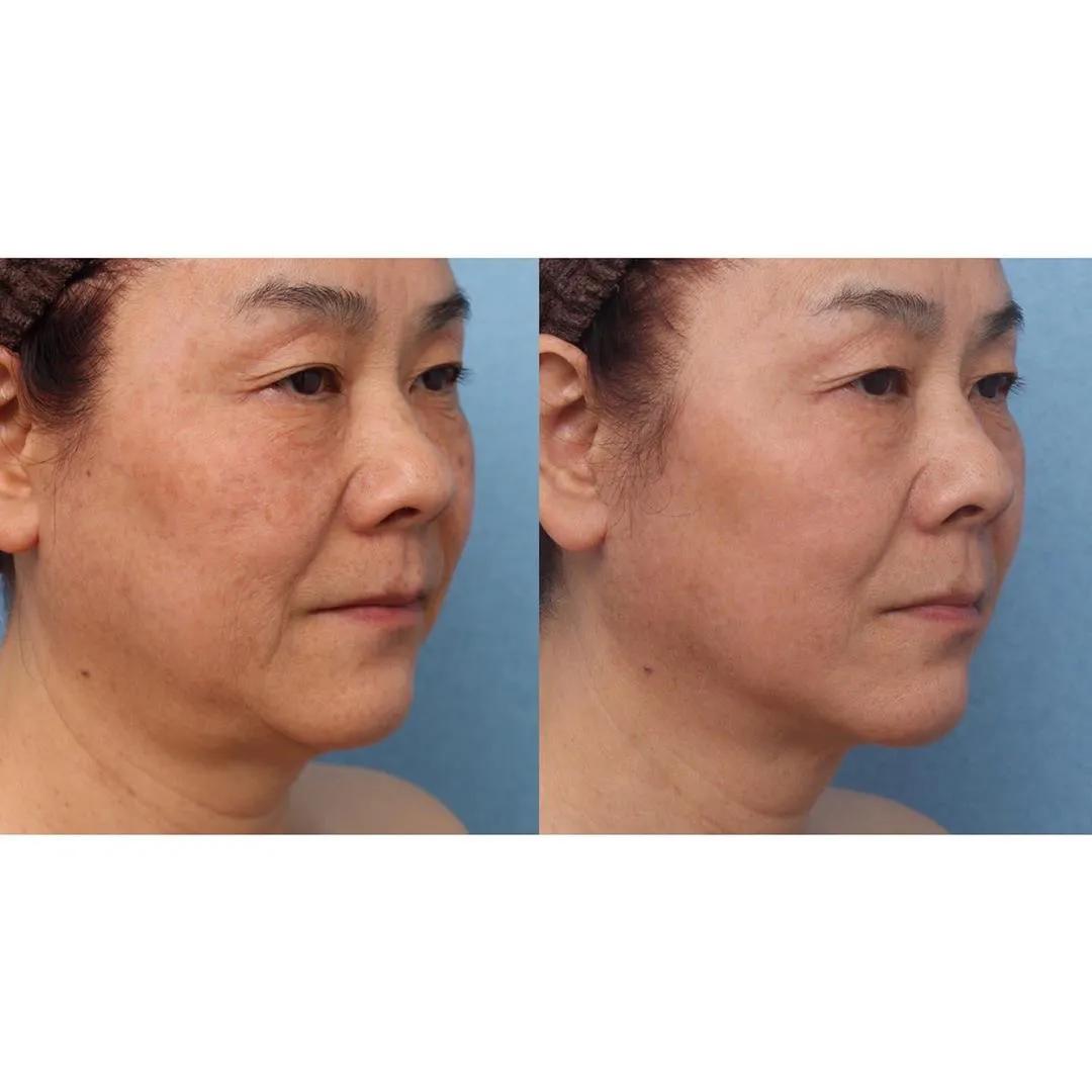 不抗衰的女人性格差距,抗衰对女人的重要性