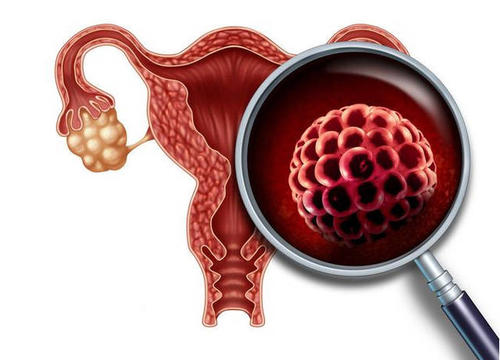 什么是早发性卵巢功能不全？如何治疗？