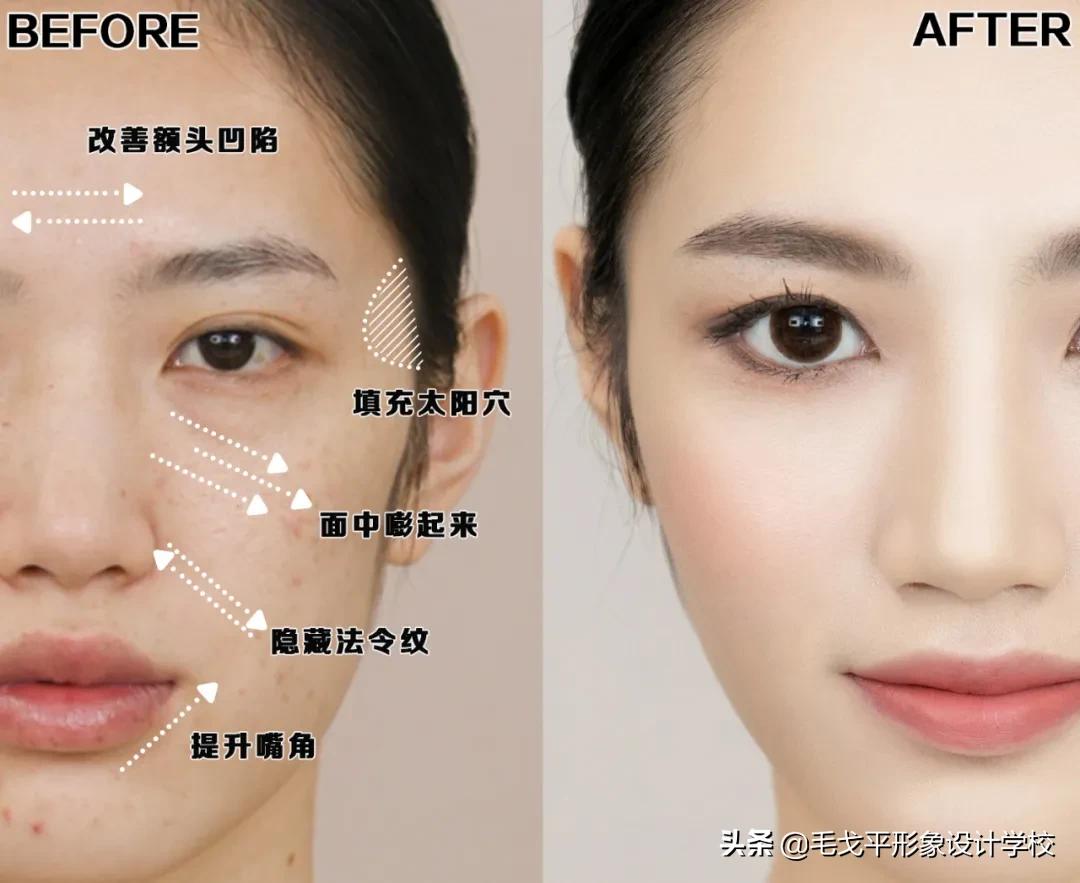 后期如何提升脸部平整度,凹陷脸如何变饱满