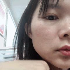 隐形眼镜，摘比戴更难啊朋友们！