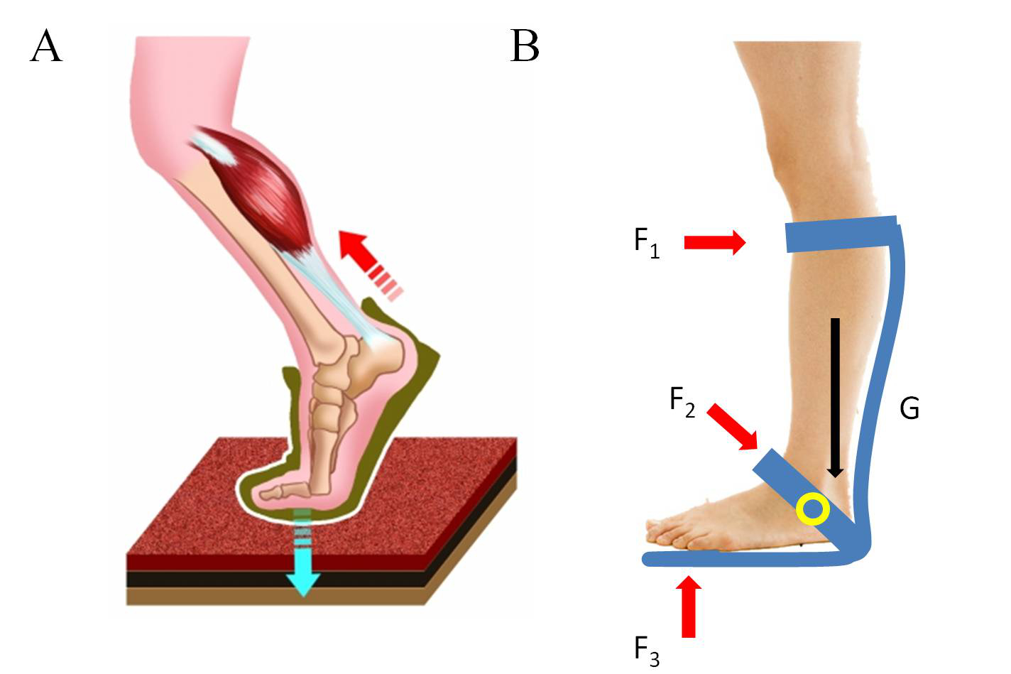 孩子足外翻买什么鞋矫正,儿童足外翻矫正鞋去哪里做