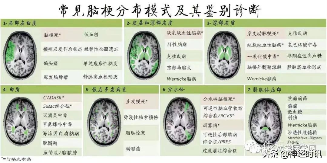 脑卒中病历诊断书图片,脑卒中影像判断技巧图解电子版