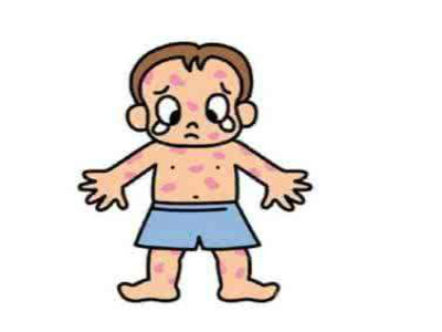 过敏性紫癜引起肾炎怎样预防,怎样预防过敏性紫癜复发