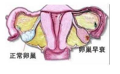 女性更年期综合征的症状有哪些,女性更年期综合征的全部症状