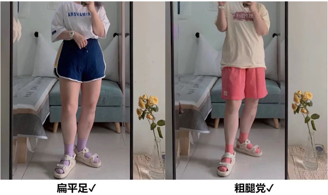 腿粗腿胖适合什么样凉鞋,腿粗夏天如何挑选凉鞋