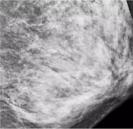 中国女人迷恋的乳房按摩，是一场彻头彻尾的*局骗**