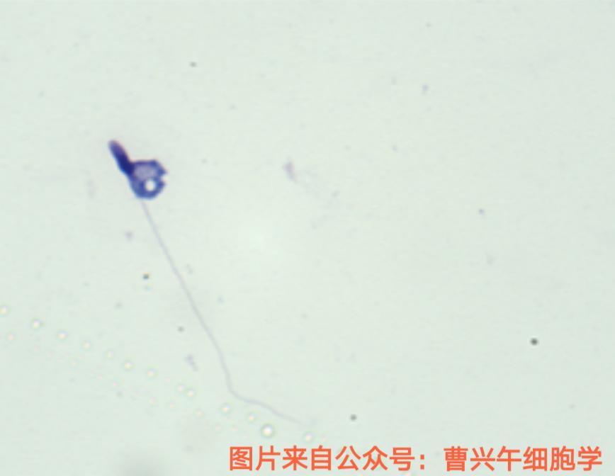 男科诊疗纪实,男科专家谈精子系列