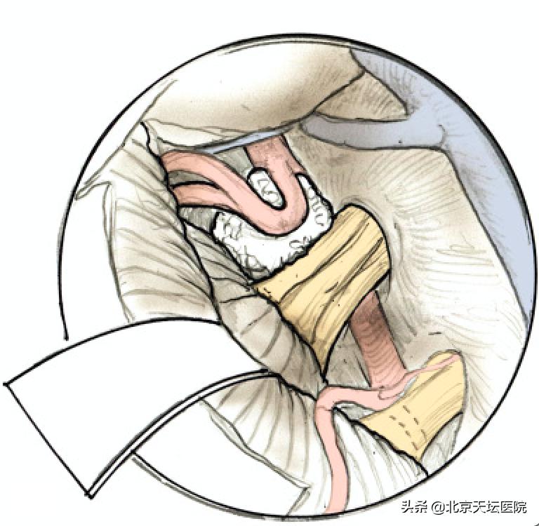 痛起来真的是要命,痛起来要命的病