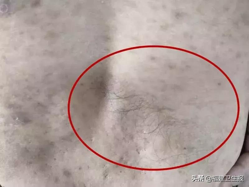 男子腿脚不便站不起来,男子莫名下肢乏力行走困难