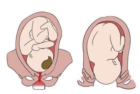 产后妈妈的恢复护理要点,产后树袋护肤小妙招