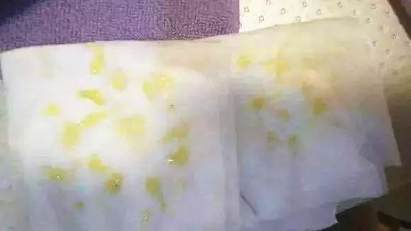 断奶最后的残奶怎么排,断奶后需要排残奶吗