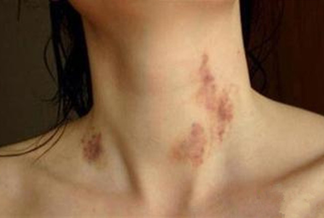 11岁闺女身上被“种草莓”，母亲一再逼问，孩子回答惹家人担忧