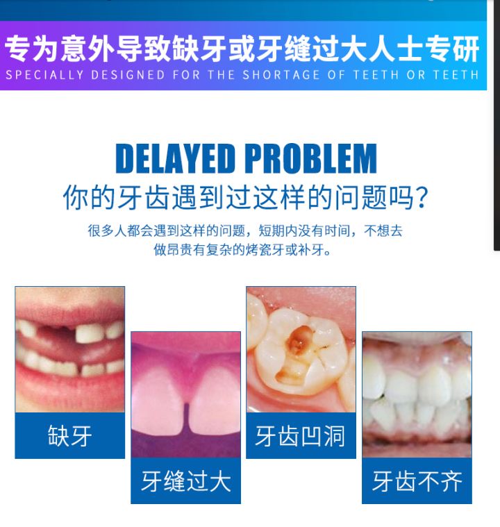 做一颗临时牙教程,自制隐形牙