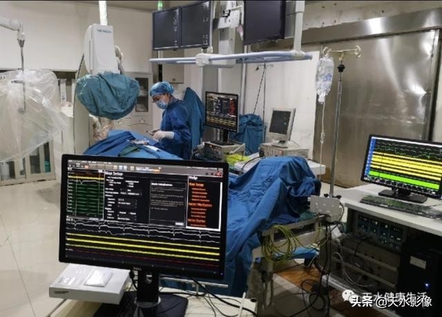 包头房颤射频消融术,达川区人民医院房颤射频消融手术