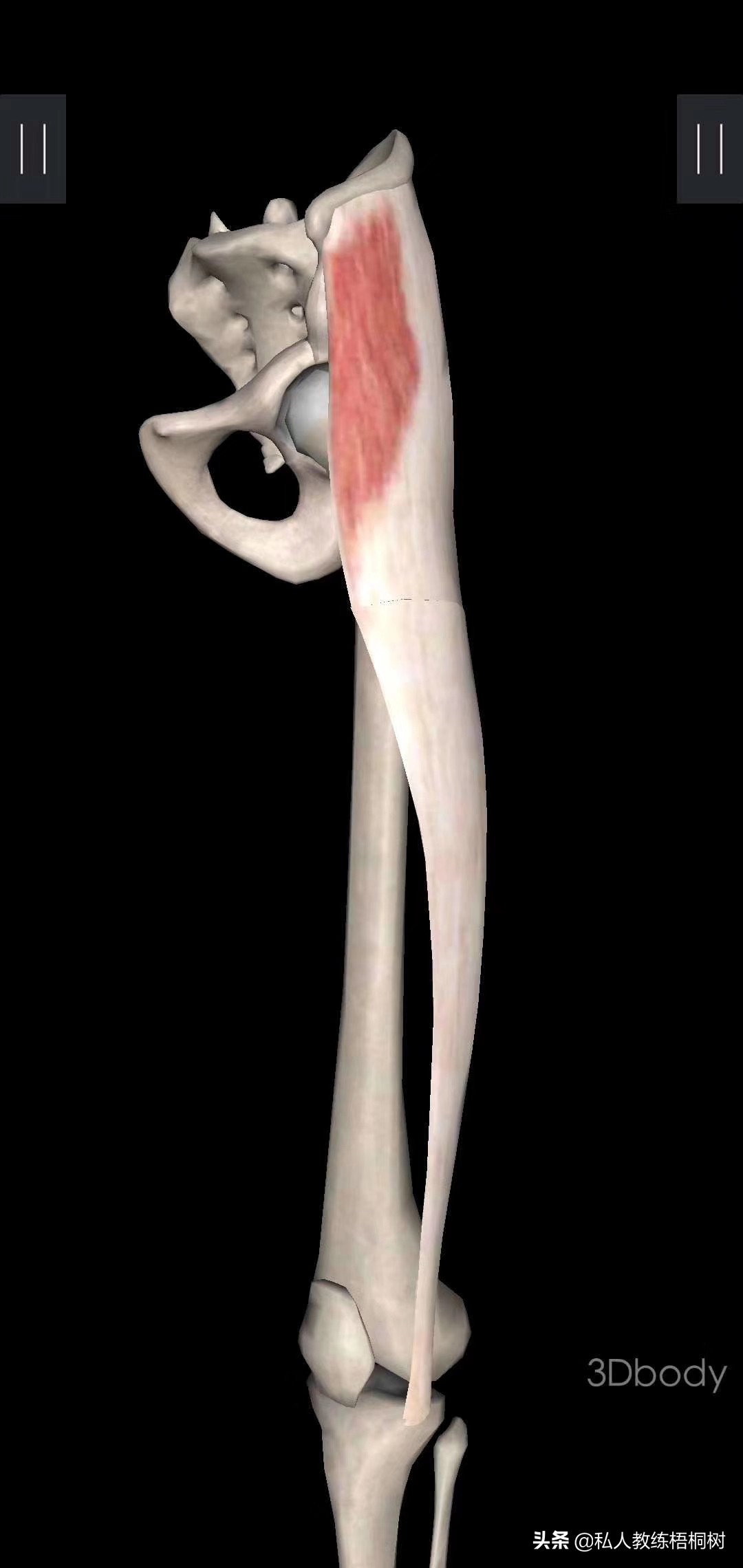 肌肉起止点,肌肉起止点松解