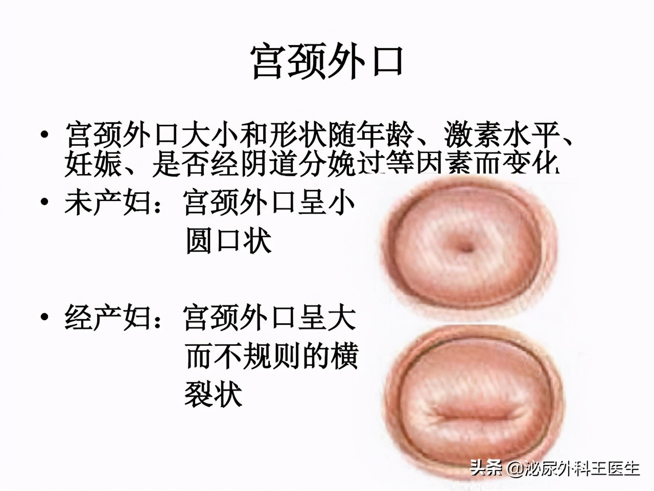 打过胎身体有哪些痕迹,女性打过胎会留下什么痕迹