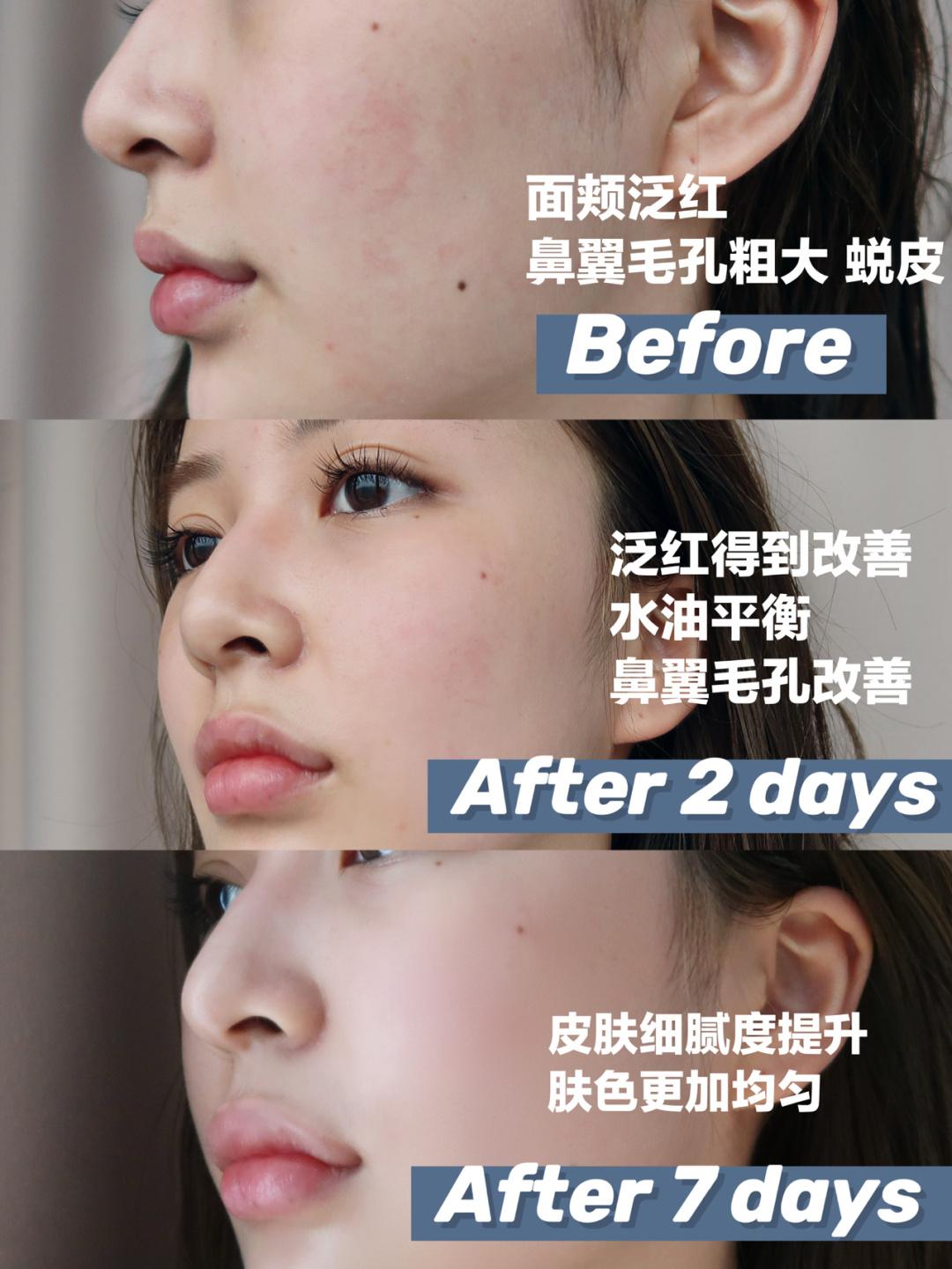 娇兰哪款面霜比较好,娇兰面霜第四代和第五代的区别