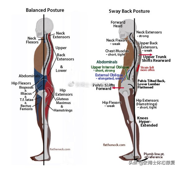 体态纠正改善驼背肩膀内扣,21天体态矫正别再挺胸夹背了